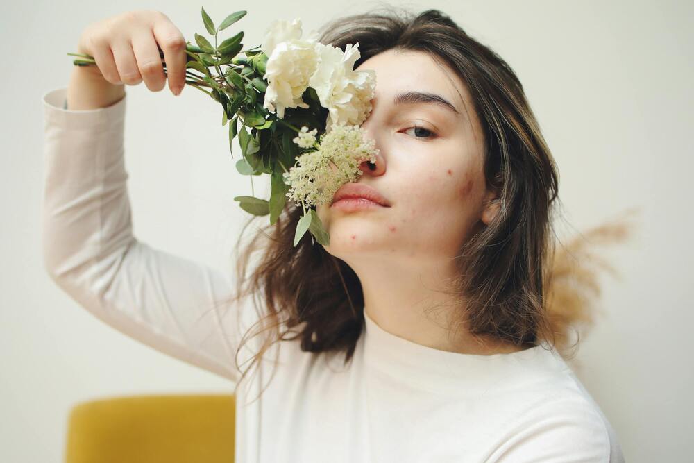 Acne Prevention Tips